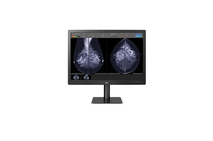 Lg 31HN713DB 31" 12MP (4200x2800) IPS Diagnostic Monitor for Mammography with Multi-resolution Modes, Pathology Mode, Self-calibration, Focus View, PBP and Dual Controller