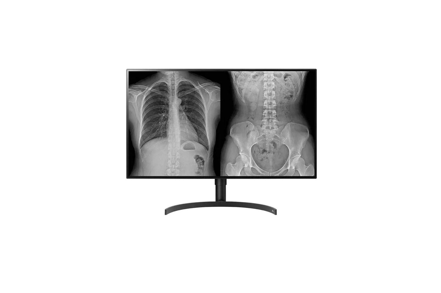 Lg 32HL512DB 31.5'' 8MP (3840x2160) Nano IPS Color Diagnostic Monitor with Multi Resolution and Clinical Pathology Modes, Auto Luminance Calibration, PBP/Dual Controller & Ergonomic Stand