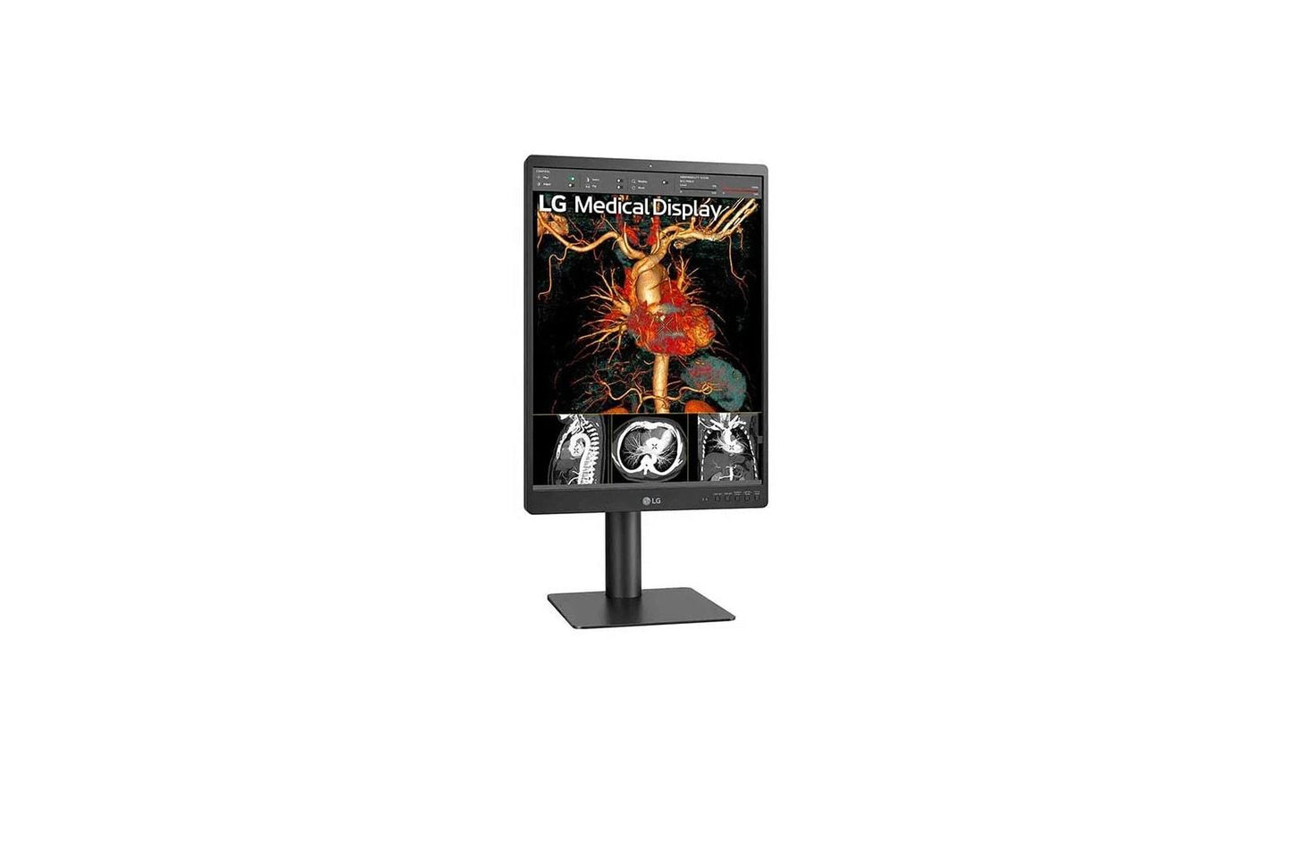 Lg 21HQ513DS 21.3" 3MP IPS Diagnostic Monitor with Ergonomic Design, Daisy Chain, and Front Sensor Calibration