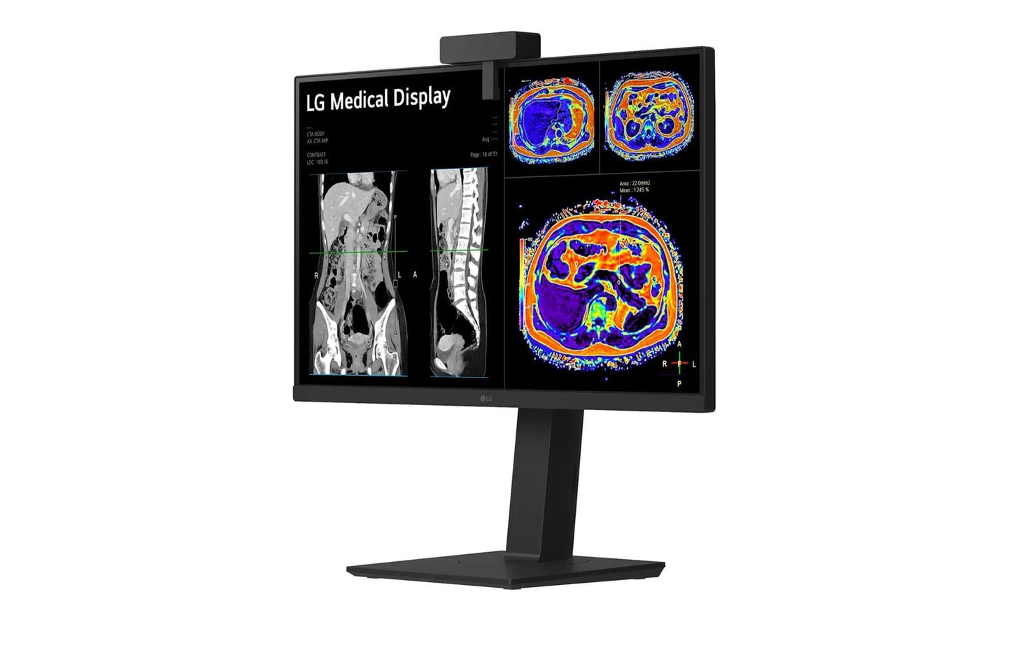 27HS713C LG 27" 8MP IPS Clinical Review Monitor