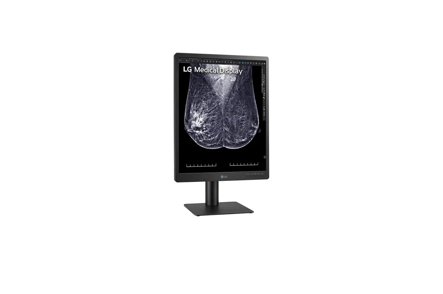 21HQ613DB LG 21.3-inch 5MP IPS Diagnostic Monitor for Mammography