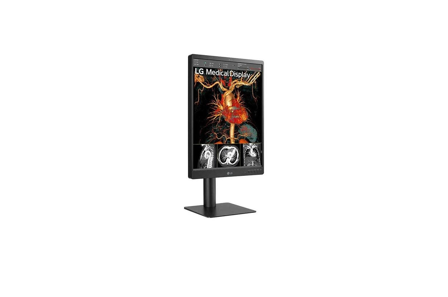 Lg 21HQ513DS 21.3" 3MP IPS Diagnostic Monitor with Ergonomic Design, Daisy Chain, and Front Sensor Calibration