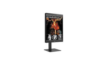 Lg 21HQ513DS 21.3" 3MP IPS Diagnostic Monitor with Ergonomic Design, Daisy Chain, and Front Sensor Calibration