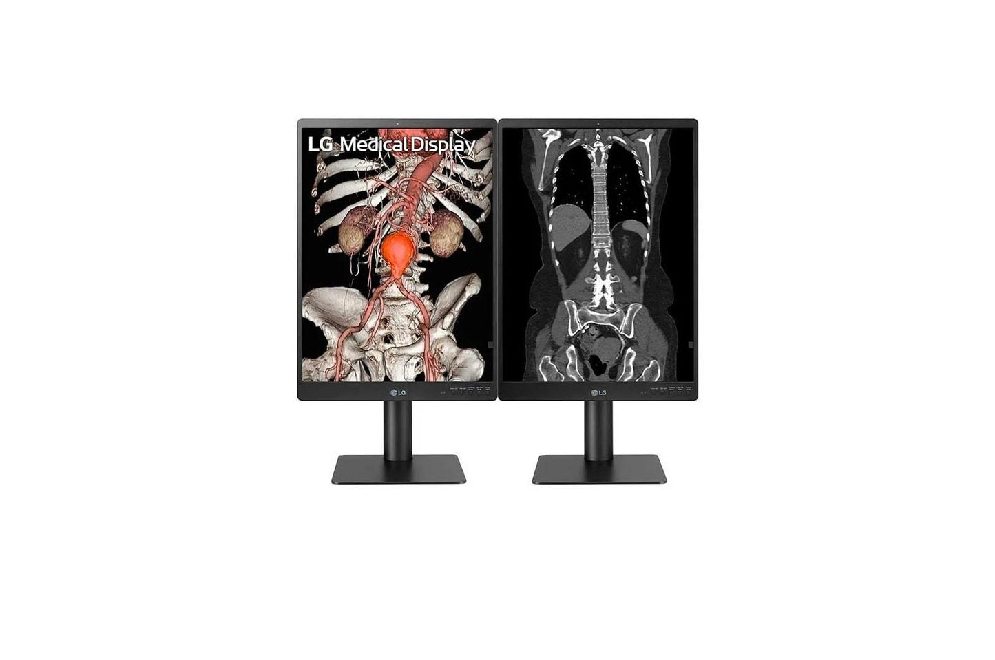 Lg 21HQ513DS 21.3" 3MP IPS Diagnostic Monitor with Ergonomic Design, Daisy Chain, and Front Sensor Calibration