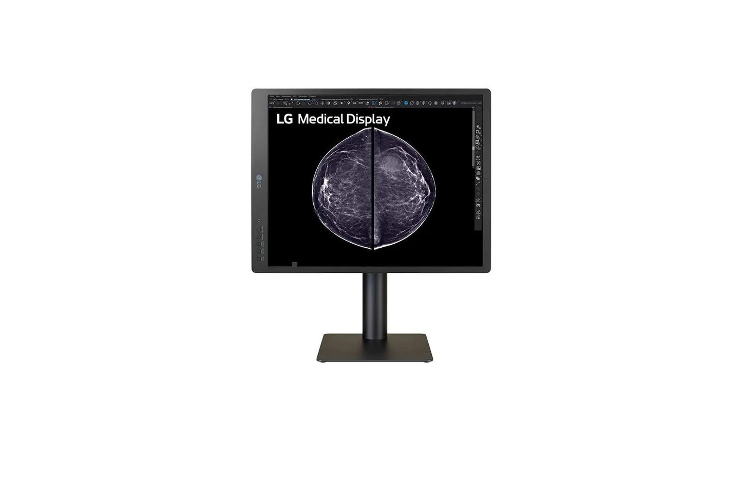 21HQ613DB LG 21.3-inch 5MP IPS Diagnostic Monitor for Mammography