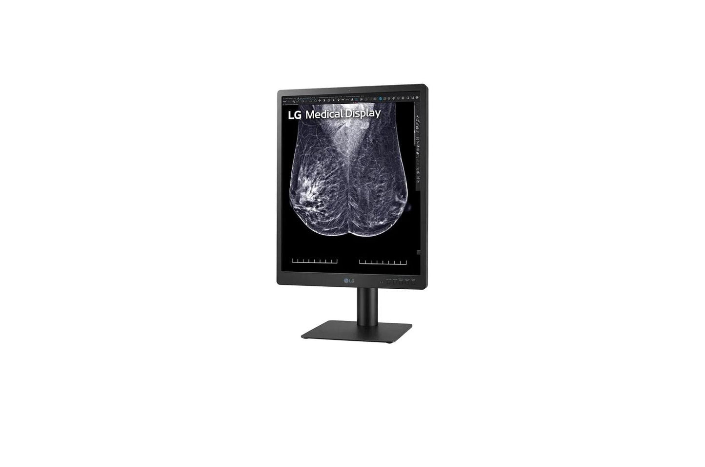 21HQ613DB LG 21.3-inch 5MP IPS Diagnostic Monitor for Mammography