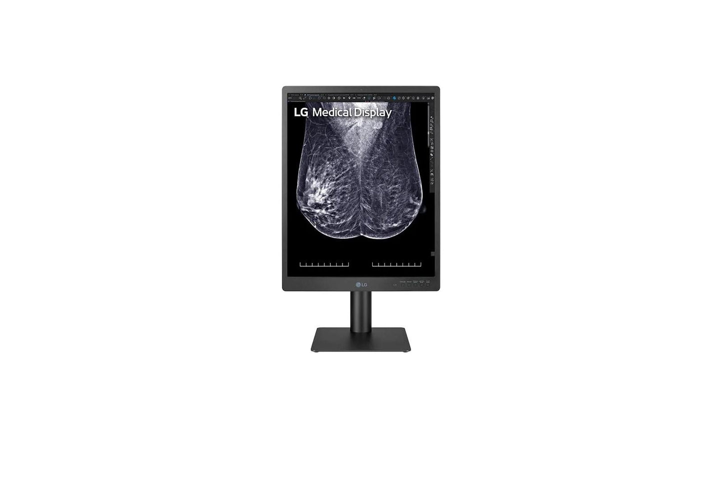 21HQ613DB LG 21.3-inch 5MP IPS Diagnostic Monitor for Mammography