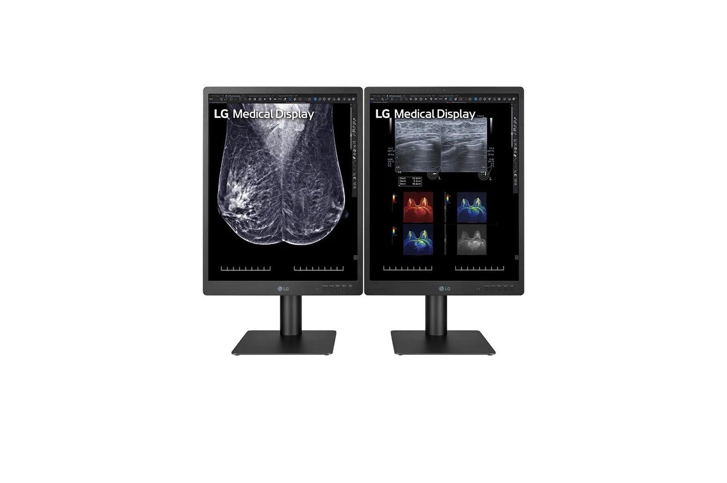 21HQ613DB LG 21.3-inch 5MP IPS Diagnostic Monitor for Mammography